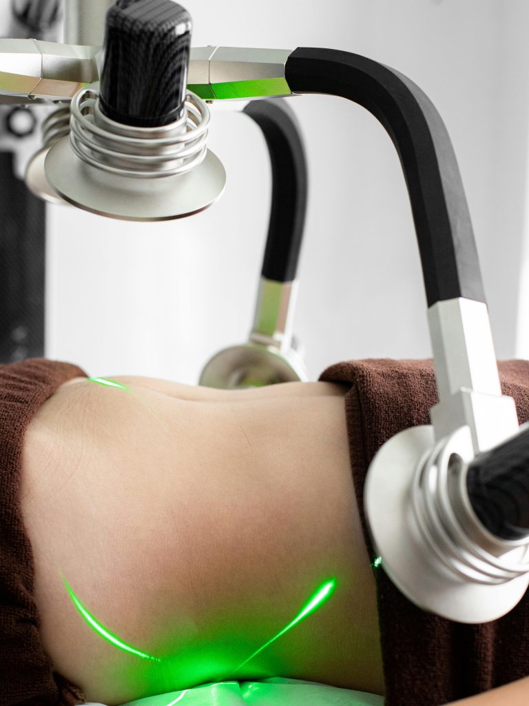 Em Sculpting Machine : Quels résultats en 4 séances ?
