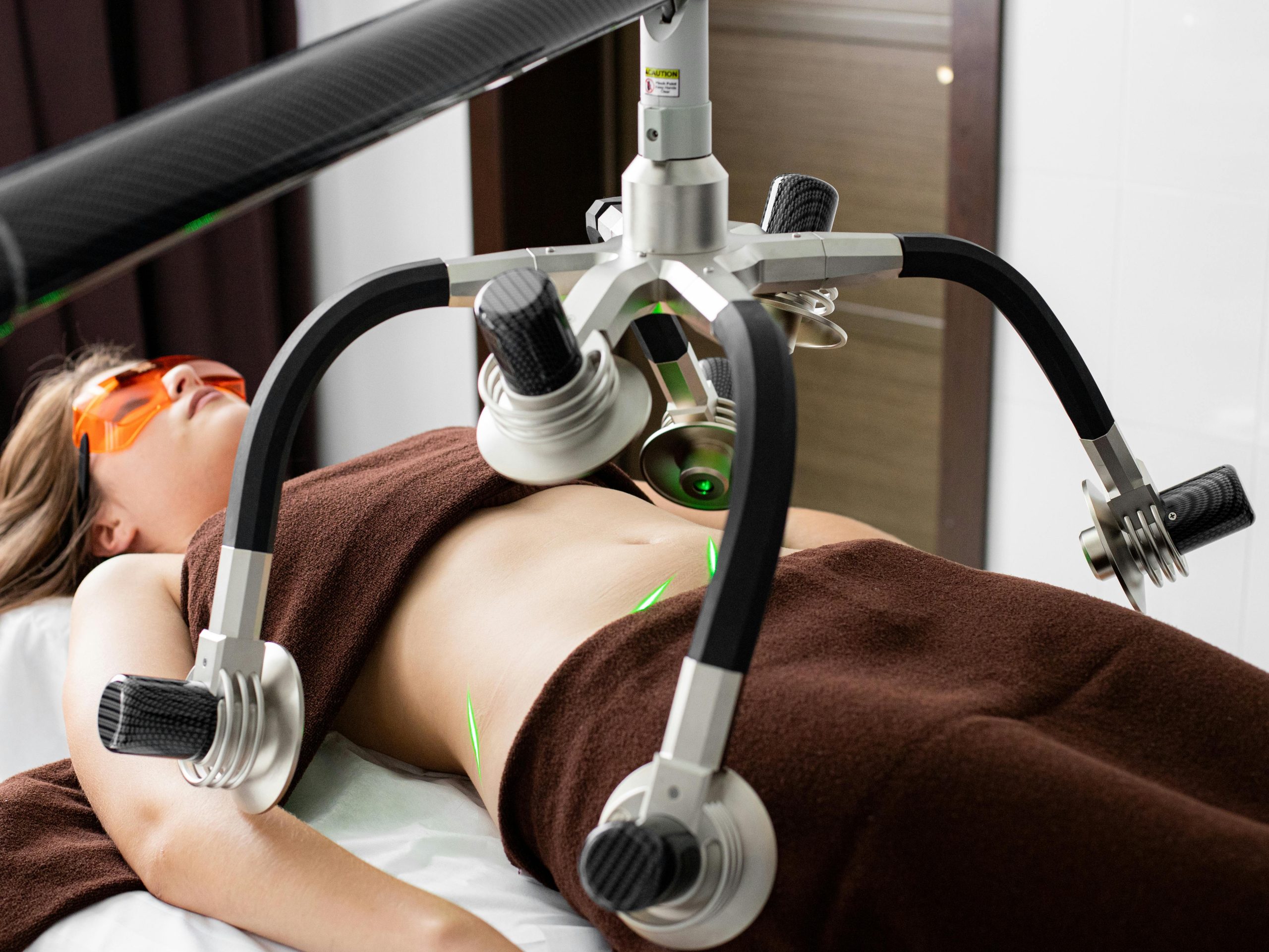 Résultats avant après em sculpting machine
