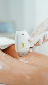 Close-up of laser hair removal procedure in beauty clinic, showcasing diode laser technology on a client's leg. Gros plan d'une procédure d'épilation au laser dans une clinique de beauté, mettant en évidence la technologie du laser à diode sur la jambe d'un client.