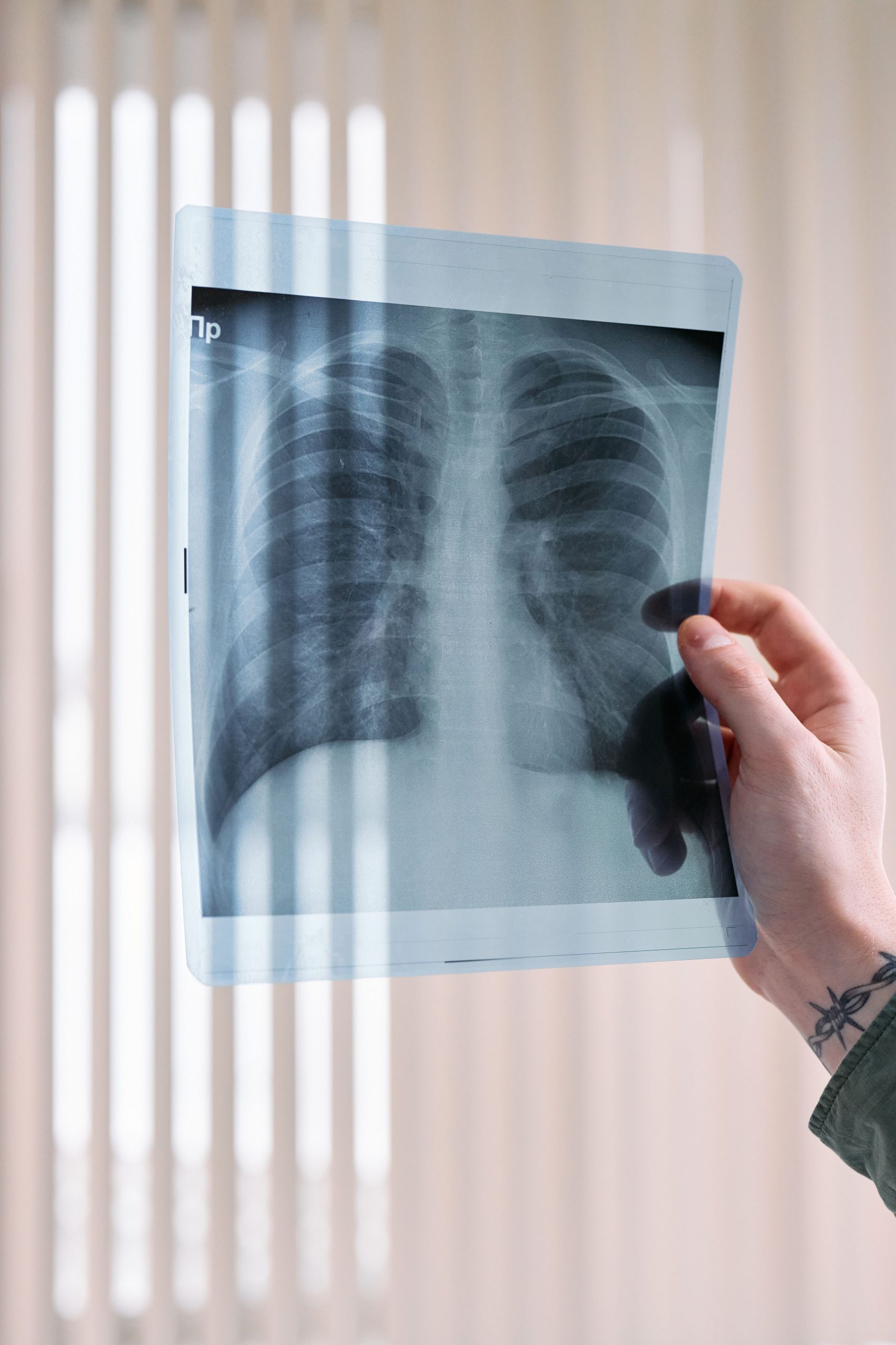 A vertical shot of a doctor's hand holding a lung x-ray in a medical clinic, focusing on healthcare diagnosis. Un gros plan vertical de la main d'un médecin tenant une radiographie pulmonaire dans une clinique médicale, en mettant l'accent sur le diagnostic médical.